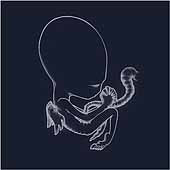 Agaetis Byrjun