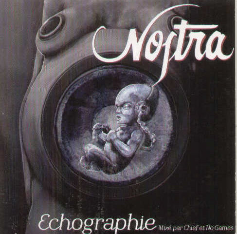Echographie